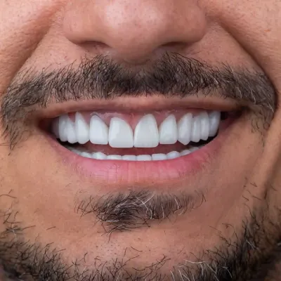 Centre dentaire the view lahlou mohamed ziad mohammed ziad lahlou dentiste rabat maroc
